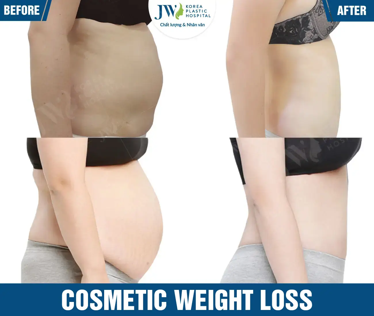 Cosmetic weight loss